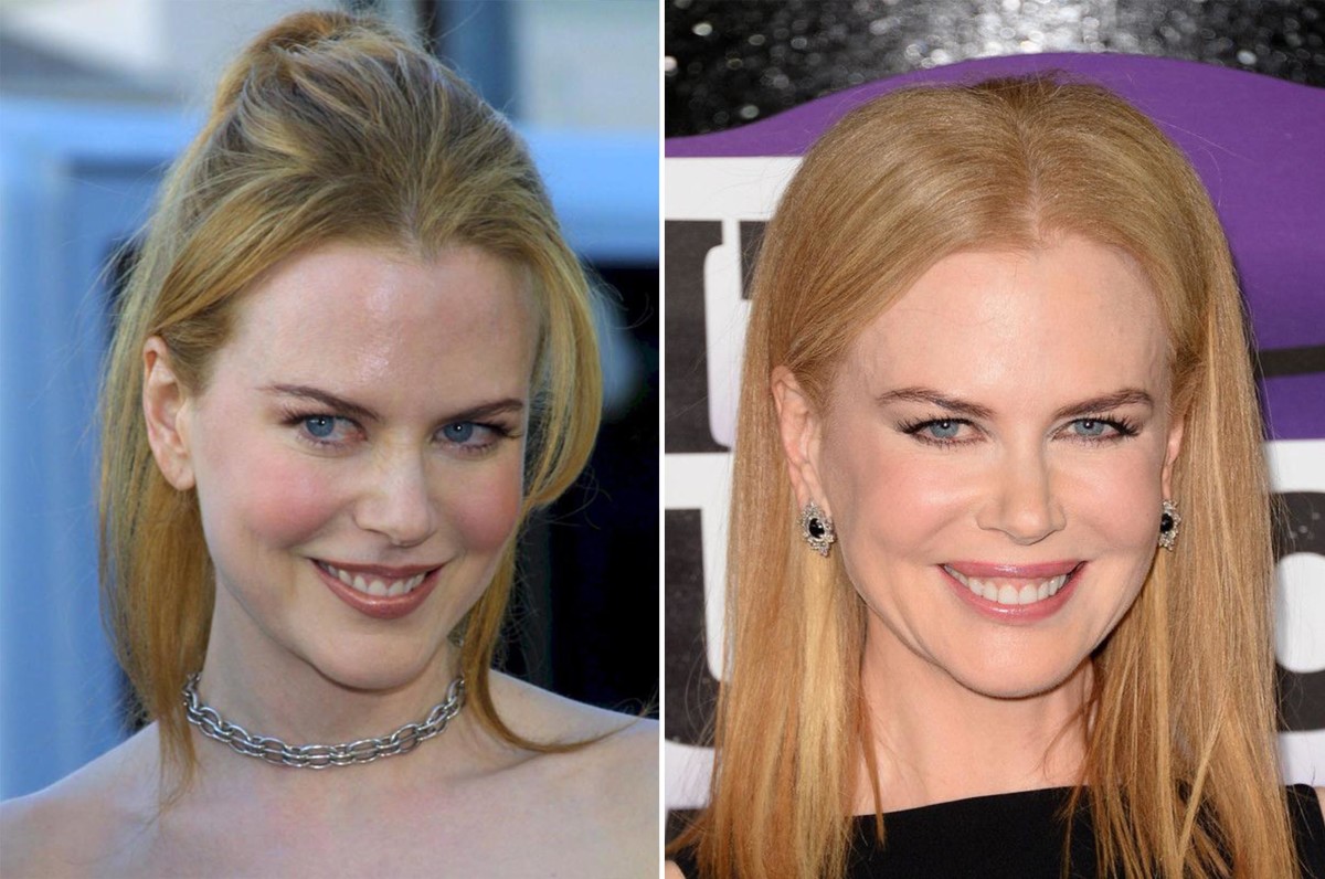نتیجه تصویری برای ‪Nicole Kidman‬‏